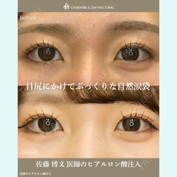 シンデレラ＆ダヴィンチクリニック 佐藤 博文医師の症例