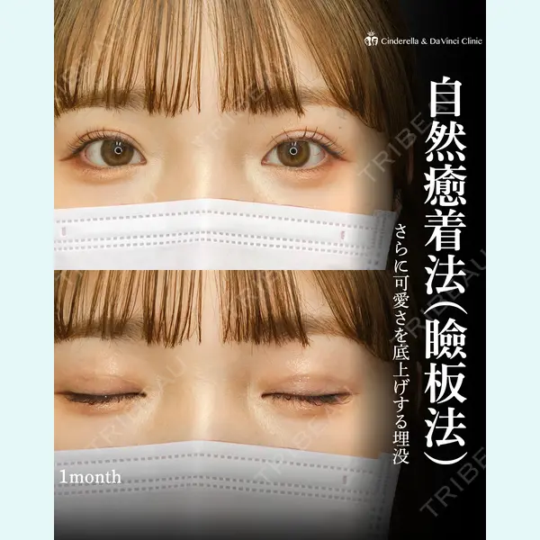 シンデレラ＆ダヴィンチクリニック 宮田 洋佑医師の症例