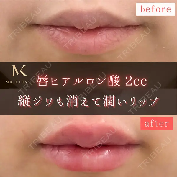 MKクリニック 銀座院の症例