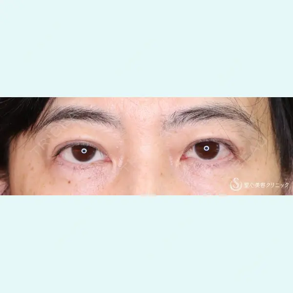 聖心美容クリニック 横浜院 佐々木 直美医師の症例