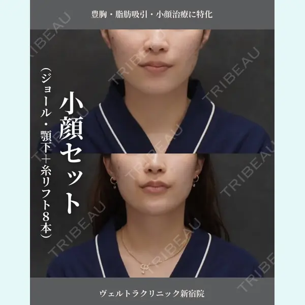 ヴェルトラクリニック 大阪院の症例