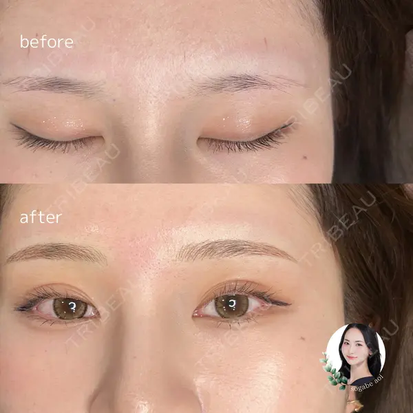 LEAGRANT CLINIC 中目黒の症例