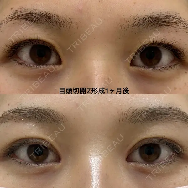エターナル美容クリニック 久門田 詳医師の症例
