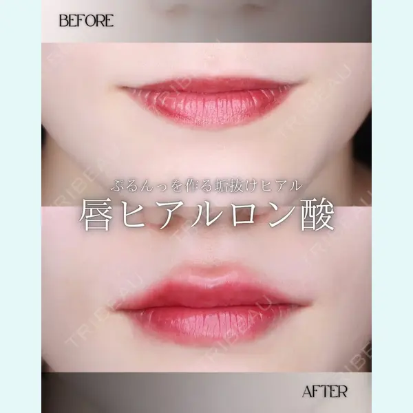 博多美容外科/美容皮膚科 ビラビューティークリニック 大村 亞蘭医師の症例