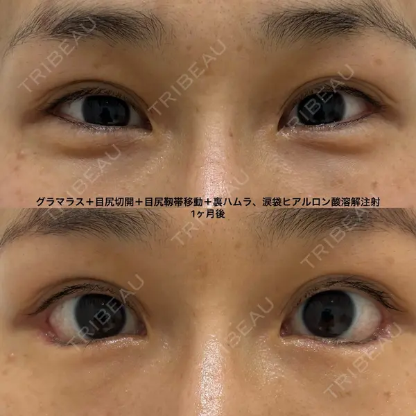 エターナル美容クリニック 久門田 詳医師の症例