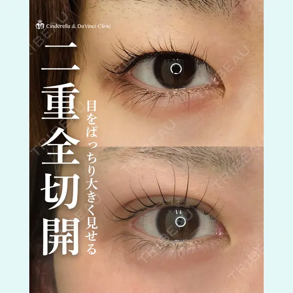 シンデレラ＆ダヴィンチクリニック 宮田 洋佑医師の症例