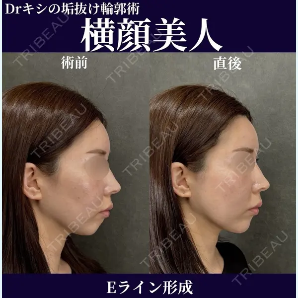 ネビュラクリニック 京都院 岸 大輔医師の症例
