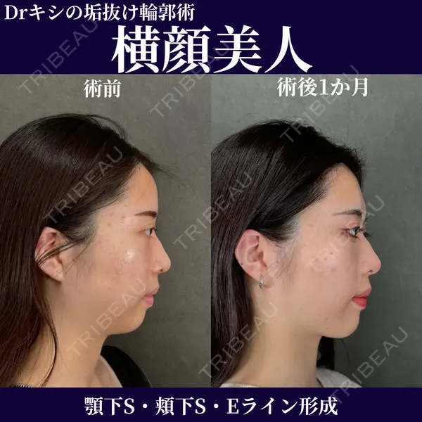 ネビュラクリニック 京都院 岸 大輔医師の症例
