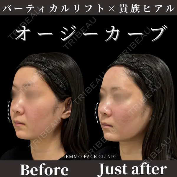 EMMO FACE CLINIC 東京三田院 木之下 哲彦医師の症例