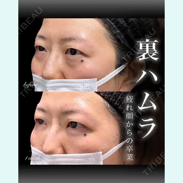 EMMO FACE CLINIC 大宮院 百瀬 直也医師の症例