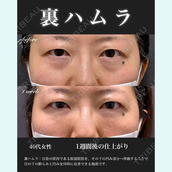 EMMO FACE CLINIC 大宮院 百瀬 直也医師の症例