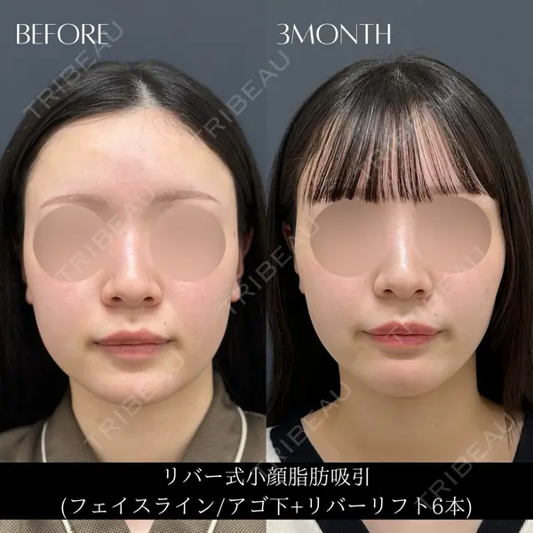 RIVER CLINIC（リバークリニック） 戸田 貴之医師の症例