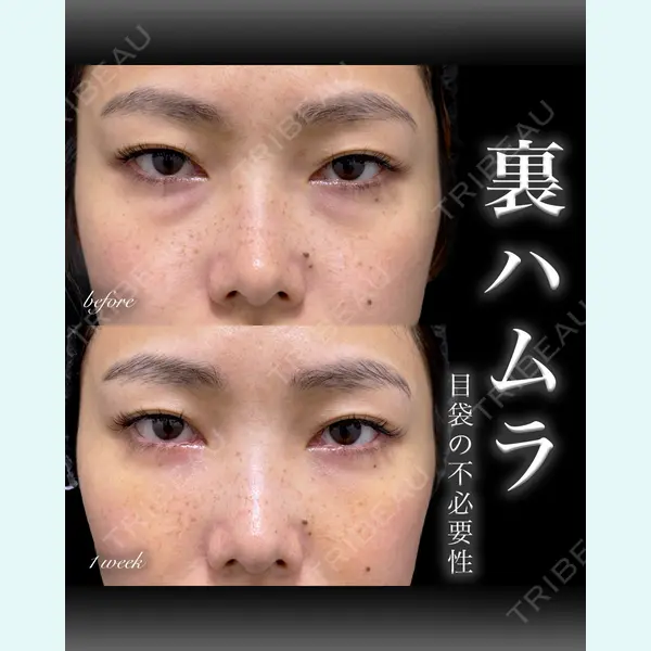 EMMO FACE CLINIC 大宮院 百瀬 直也医師の症例
