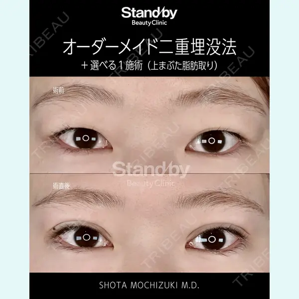 Stand by Beauty Clinic 望月 聖太医師の症例