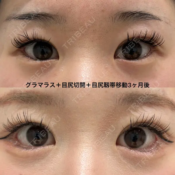 エターナル美容クリニック 久門田 詳医師の症例