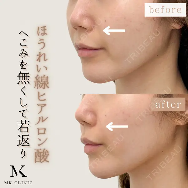 MKクリニック 日本橋院の症例