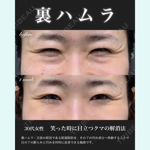 EMMO FACE CLINIC 大宮院 百瀬 直也医師の症例