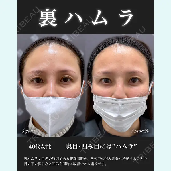 EMMO FACE CLINIC 大宮院 百瀬 直也医師の症例