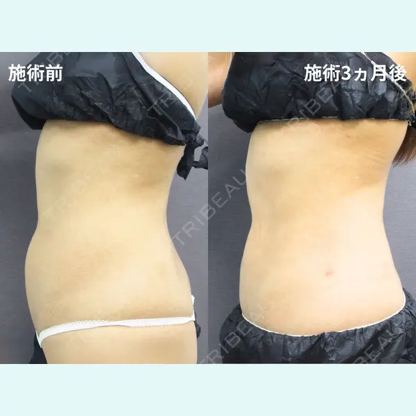 城本クリニック 大宮院 南條 昭雄医師の症例