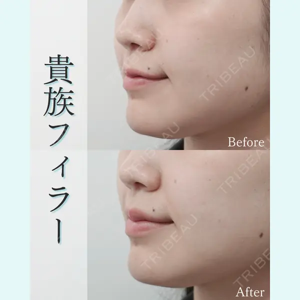 L‘amour clinic Tokyo【ラムールクリニック東京】の症例
