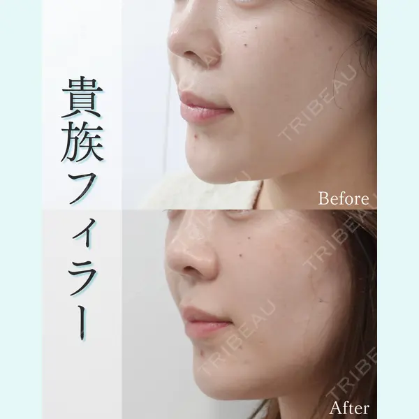 L‘amour clinic Tokyo【ラムールクリニック東京】の症例