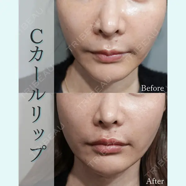 L‘amour clinic Tokyo【ラムールクリニック東京】の症例