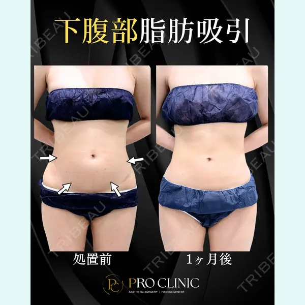 PRO CLINIC プロクリニック 銀座院 柚﨑 一輝医師の症例