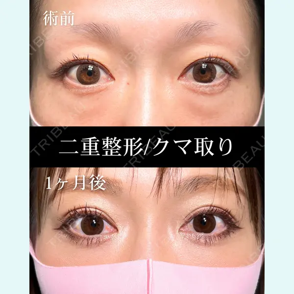 HAAB×DREAM BEAUTY CLINIC 大阪梅田院 鈴木 馨斗医師の症例