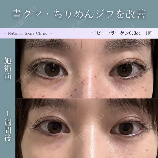 Natural Skin Clinic 笹塚院 圓山 尚医師の症例