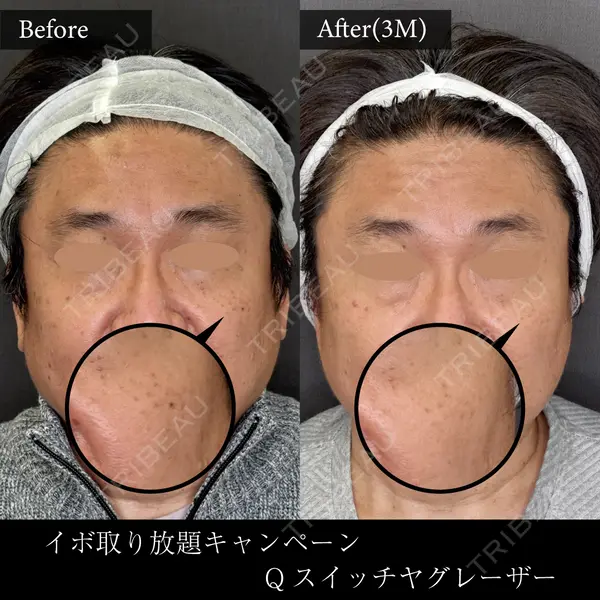 麹町皮ふ科・形成外科クリニック 安藤 玲奈医師の症例