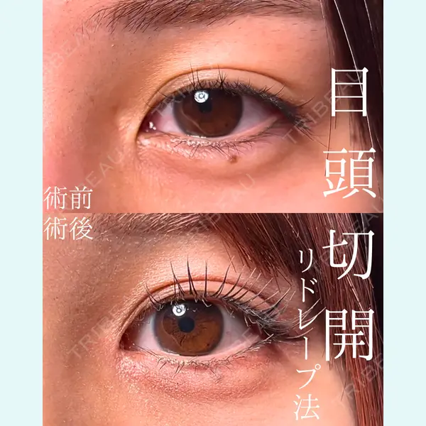 9BeautyClinic 田中 誉大医師の症例