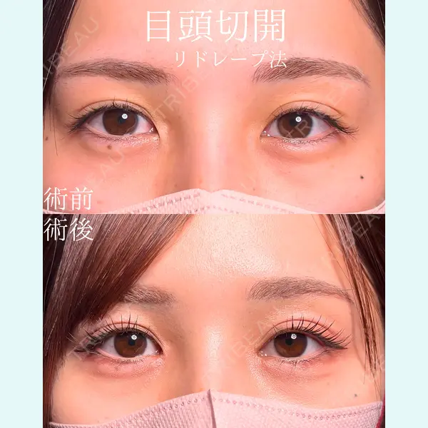 9BeautyClinic 田中 誉大医師の症例