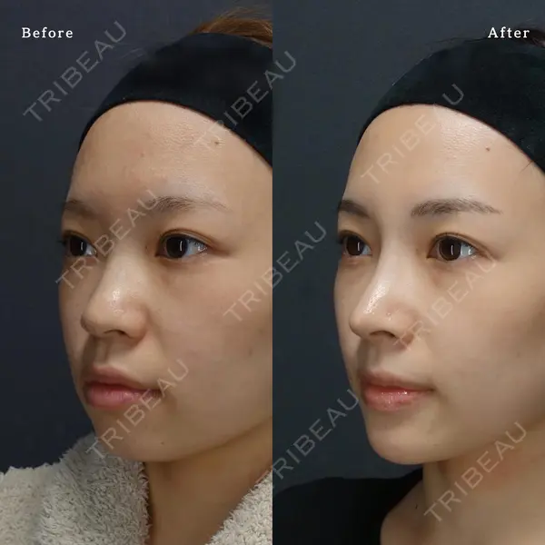 LIVIN CLINIC 新行内 芳明医師の症例