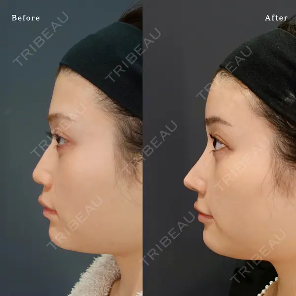 LIVIN CLINIC 新行内 芳明医師の症例