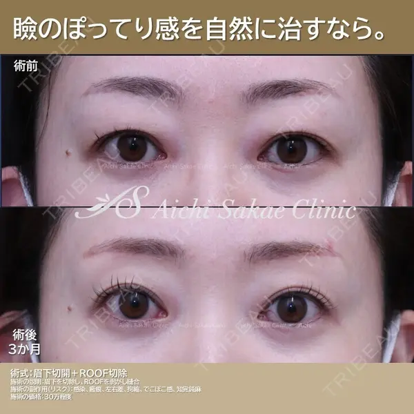 あいちビューティークリニック栄本院 横山 侑祐医師の症例