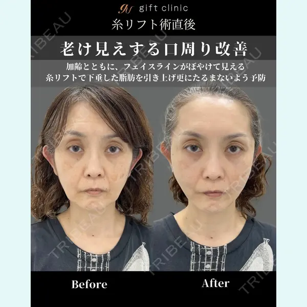 gift clinic 能登谷 翔医師の症例