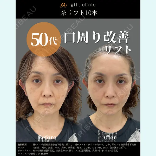 gift clinic 能登谷 翔医師の症例
