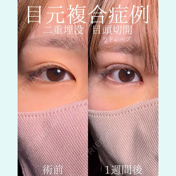 9BeautyClinic 田中 誉大医師の症例
