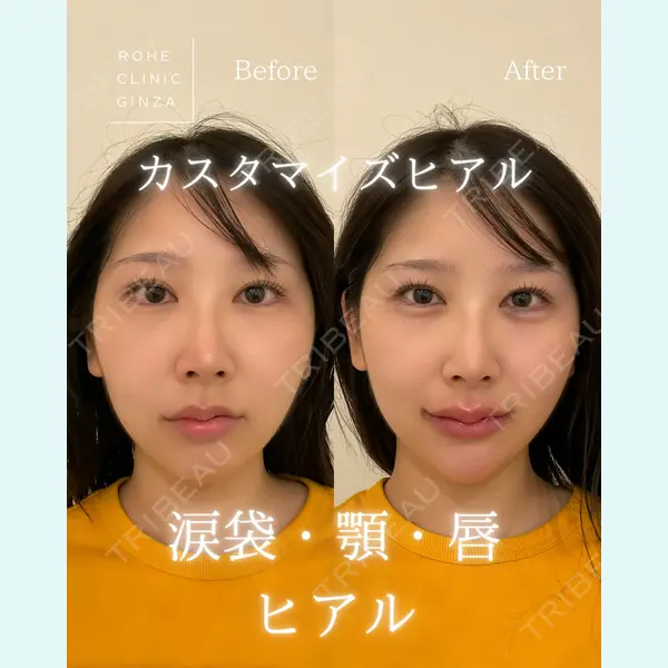 ROHE CLINIC GINZAの症例