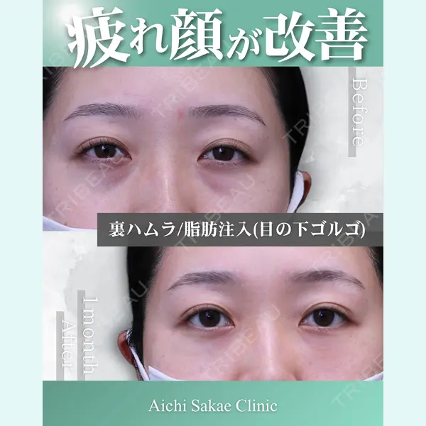 あいちビューティークリニック栄本院の症例