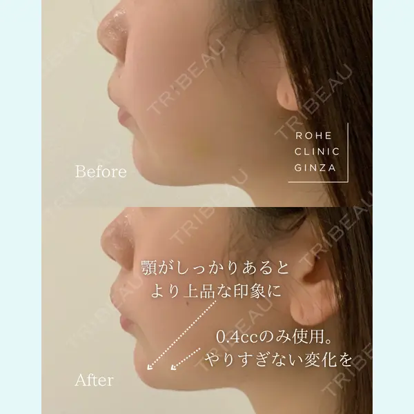 ROHE CLINIC GINZAの症例