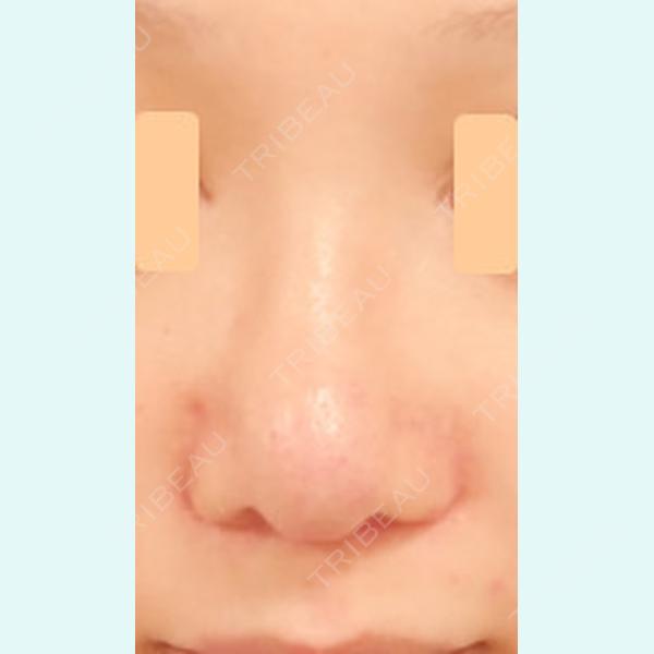 Kunoクリニック 梅田院 九野　広夫医師の症例