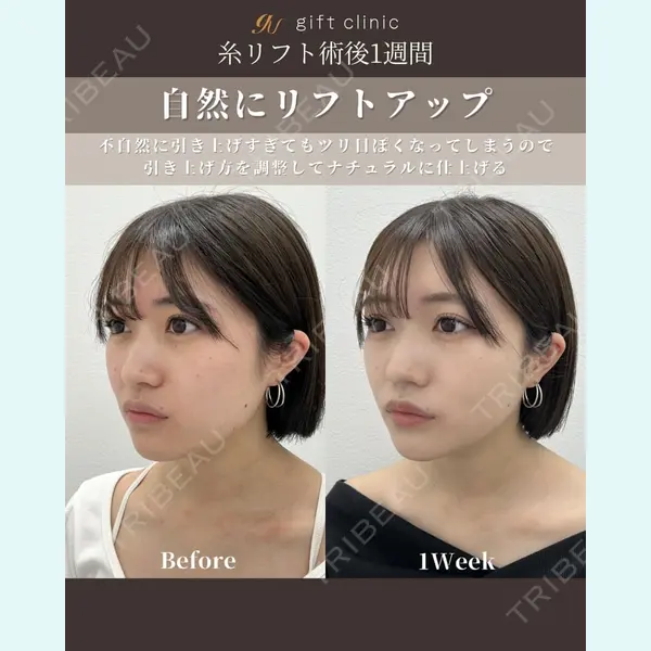 gift clinic 能登谷 翔医師の症例