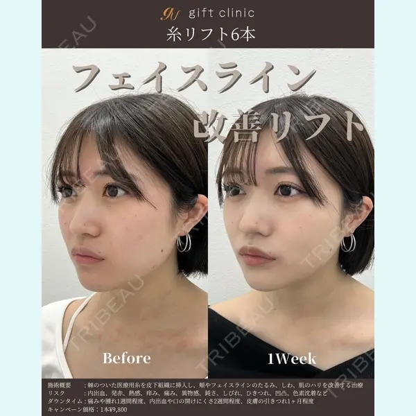 gift clinic 能登谷 翔医師の症例