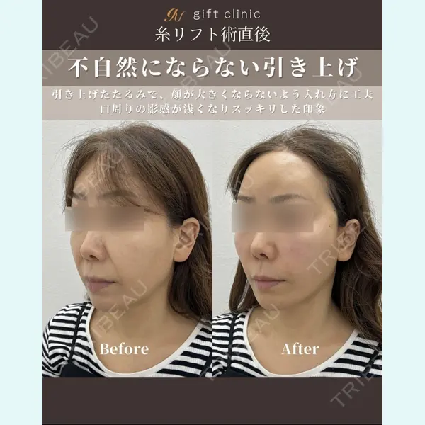 gift clinic 能登谷 翔医師の症例