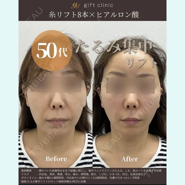 gift clinic 能登谷 翔医師の症例