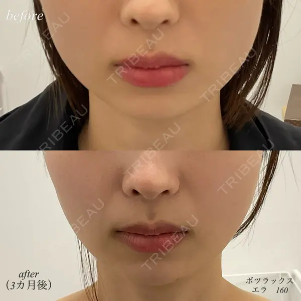 DMTC CLINIC 日本橋院 山中大介医師の症例