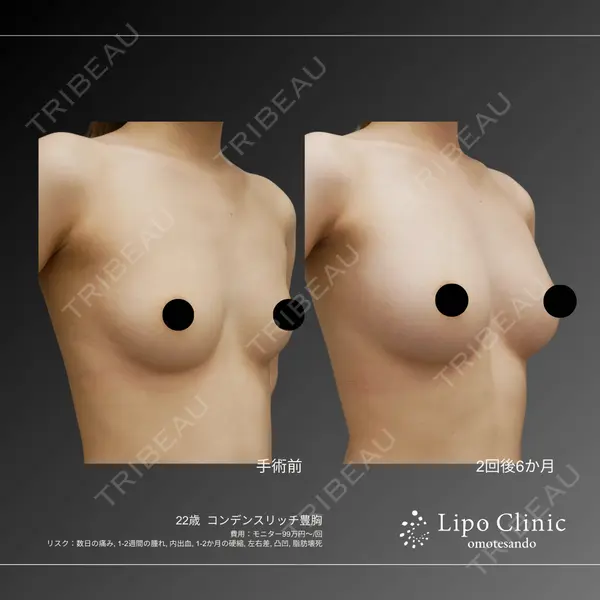Lipo Clinic omotesando 福田 越医師の症例