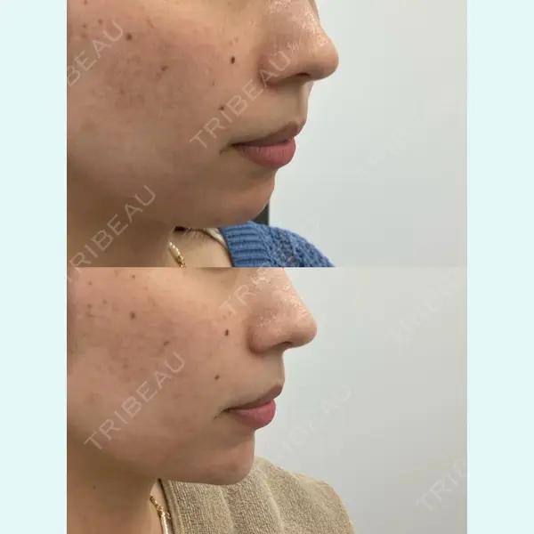 Next Tokyo Clinic 中村 有医師の症例