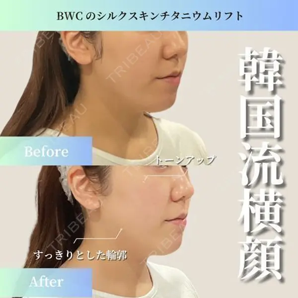 ビューティー和心クリニック 浅草院の症例